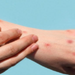 livestock animal news